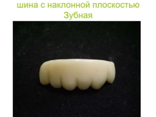 съёмные протезы