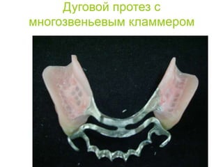 съёмные протезы