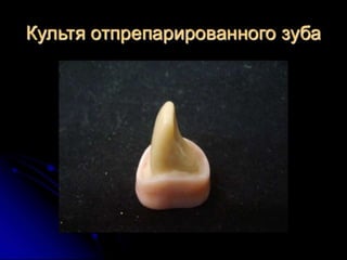 несьёмные протезы