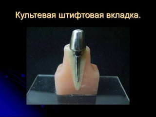 несьёмные протезы