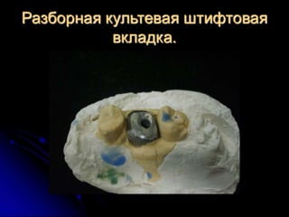 несьёмные протезы