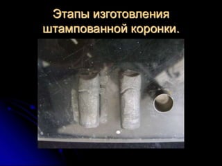 несьёмные протезы