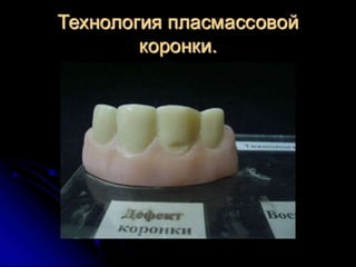 несьёмные протезы