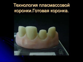 несьёмные протезы