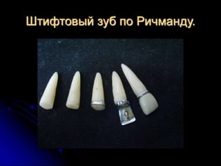 несьёмные протезы