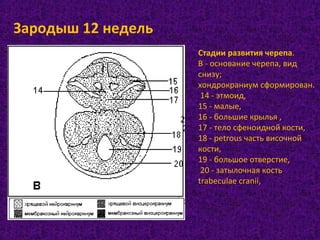 Стадии развития черепа.
В - основание черепа, вид
снизу;
хондрокраниум сформирован.
14 - этмоид,
15 - малые,
16 - большие крылья ,
17 - тело сфеноидной кости,
18 - petrous часть височной
кости,
19 - большое отверстие,
20 - затылочная кость
trabeculae cranii,
Зародыш 12 недель
 