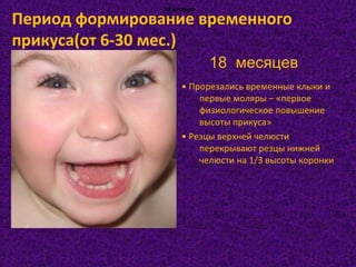 • Прорезались временные клыки и
первые моляры – «первое
физиологическое повышение
высоты прикуса»
• Резцы верхней челюсти
перекрывают резцы нижней
челюсти на 1/3 высоты коронки
- 12 месяцев- 12 месяцев- 12 месяцев- 12 месяцев
18 месяцев
Период формирование временного
прикуса(от 6-30 мес.)
 