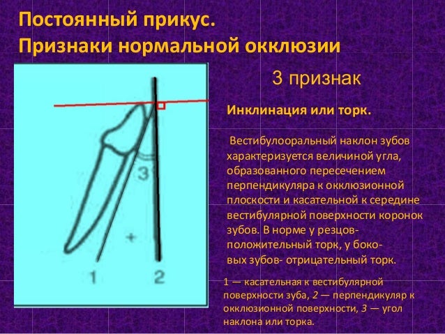 Угол наклона зуба шестерни