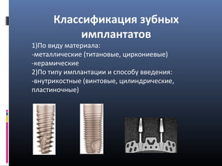 Классификация зубных
имплантатов
1)По виду материала:
-металлические (титановые, циркониевые)
-керамические
2)По типу имплантации и способу введения:
-внутрикостные (винтовые, цилиндрические,
пластиночные)
 