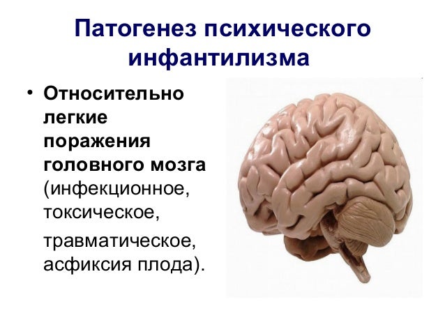 Моторный инфантилизм это