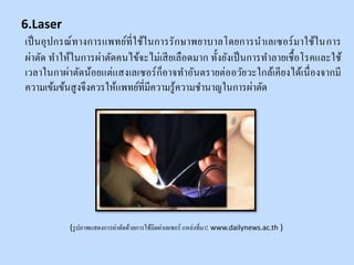 เป็นอุปกรณ์ทางการแพทย์ที่ใช้ในการรักษาพยาบาลโดยการนาเลเซอร์มาใช้ในการ
ผ่าตัด ทาให้ในการผ่าตัดคนไข้จะไม่เสียเลือดมาก ทั้งยังเป็นการทาลายเชื้อโรคและใช้
เวลาในกาผ่าตัดน้อยแต่แสงเลเซอร์ก็อาจทาอันตรายต่ออวัยวะใกล้เคียงได้เนื่องจากมี
ความเข้มข้นสูงจึงควรให้แพทย์ที่มีความรู้ความชานาญในการผ่าตัด
(รูปภาพแสดงการผ่าตัดด้วยการใช้มีดผ่าเลเซอร์ แหล่งที่มา: www.dailynews.ac.th )
6.Laser
 