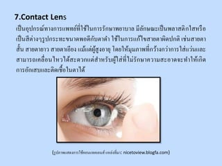 เป็นอุปกรณ์ทางการแพทย์ที่ใช้ในการรักษาพยาบาล มีลักษณะเป็นพลาสติกใสหรือ
เป็นสีต่างๆรูปกระทะขนาดพอดีกับตาดา ใช้ในการแก้ไขสายตาผิดปกติ เช่นสายตา
สั้น สายตายาว สายตาเอียง แม้แต่ผู้สูงอายุ โดยให้มุมภาพที่กว้างกว่าการใส่แว่นและ
สามารถเคลื่อนไหวได้สะดวกแต่สาหรับผู้ใส่ที่ไม่รักษาความสะอาดจะทาให้เกิด
การอักเสบและติดเชื้อในตาได้
(รูปภาพแสดงการใช้คอนแทคเลนส์ แหล่งที่มา: nicetoview.blogfa.com)
7.Contact Lens
 