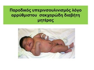 Παροδικός υπερινσουλινισμός λόγο
αρρύθμιστου σακχαρώδη διαβήτη
μητέρας
 