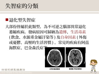 失智症的分類
退化型失智症
大部份皆屬於此類型，為不可逆之腦部異常退化
萎縮疾病。發病原因可歸納為遺傳、生活毒素
( 飲食、水源重金屬汙染等 ) 及自身因素 ( 外傷
或憂鬱、高壓的生活習慣 ) 。常見的疾病有阿茲
海默症、巴金森氏症等。
 