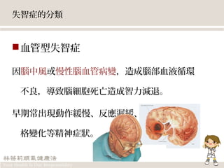 失智症的分類
血管型失智症
因腦中風或慢性腦血管病變，造成腦部血液循環
不良，導致腦細胞死亡造成智力減退。
早期常出現動作緩慢、反應遲緩、步態不穩與人
格變化等精神症狀。
 