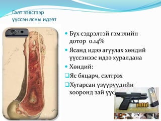 ясны идээт үрэвсэл | PPT