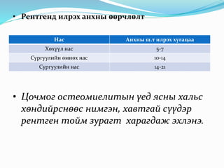 ясны идээт үрэвсэл | PPT