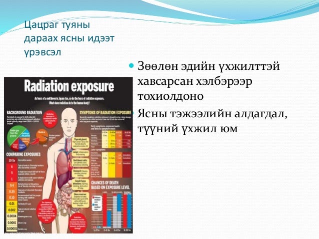 ясны идээт үрэвсэл