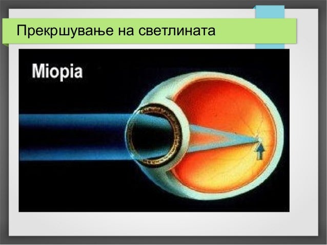 Принцип око за око