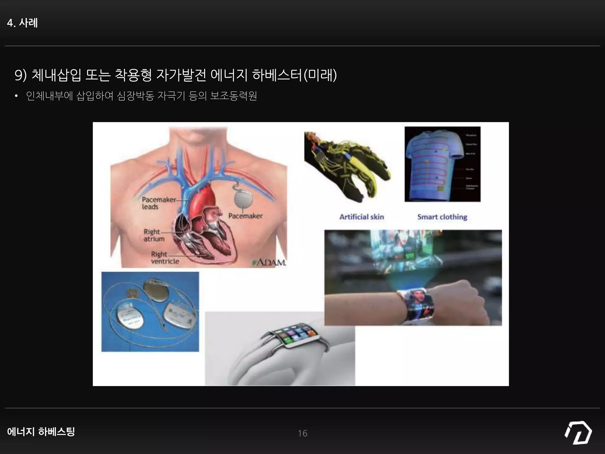 4. 사례
16
9) 체내삽입 또는 착용형 자가발전 에너지 하베스터(미래)
• 인체내부에 삽입하여 심장박동 자극기 등의 보조동력원
에너지 하베스팅
 