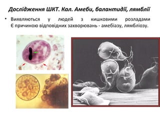 Дослідження ШКТ. Кал. Амеби, балантидії, лямблії
• Виявляються у людей з кишковими розладами
Є причиною відповідних захворювань - амебіазу, лямбліозу.
 