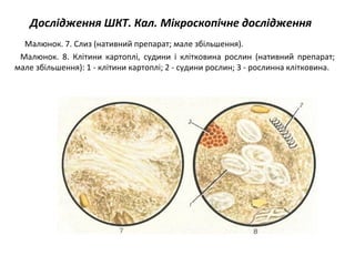 Дослідження ШКТ. Кал. Мікроскопічне дослідження
Малюнок. 7. Слиз (нативний препарат; мале збільшення).
Малюнок. 8. Клітини картоплі, судини і клітковина рослин (нативний препарат;
мале збільшення): 1 - клітини картоплі; 2 - судини рослин; 3 - рослинна клітковина.
 