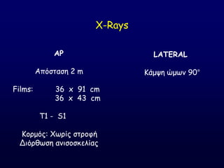AP
Απόζηαζε 2 m
Films: 36 x 91 cm
36 x 43 cm
Σ1 - S1
Ημνμόξ: Χςνίξ ζηνμθή
Δηόνζςζε ακηζμζθειίαξ
X-Rays
LATERAL
Ηάμρε ώμςκ 90°
 