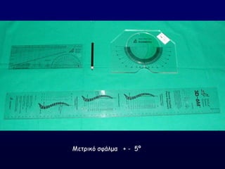 Ιεηνηθό ζθάιμα + - 5º
 