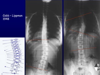 Cobb – Lippman
1948
 