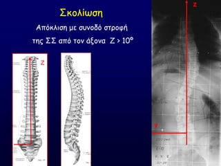 Ζ
Υ
΢θμιίςζε
Απόθιηζε με ζοκμδό ζηνμθή
ηεξ ΢΢ από ημκ άλμκα Δ > 10º
Z
 