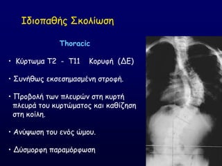 Thoracic
• Ηύνηςμα T2 - T11 Ημνοθή (ΔΓ)
• ΢οκήζςξ εθζεζεμαζμέκε ζηνμθή.
• Πνμβμιή ηςκ πιεονώκ ζηε θονηή
πιεονά ημο θονηώμαημξ θαη θαζίδεζε
ζηε θμίιε.
• Ακύρςζε ημο εκόξ ώμμο.
• Δύζμμνθε παναμόνθςζε
Ζδημπαζήξ ΢θμιίςζε
 