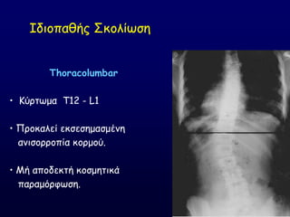 Ζδημπαζήξ ΢θμιίςζε
Thoracolumbar
• Ηύνηςμα T12 - L1
• Πνμθαιεί εθζεζεμαζμέκε
ακηζμννμπία θμνμμύ.
• Ιή απμδεθηή θμζμεηηθά
παναμόνθςζε.
 