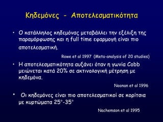 Ηεδεμόκεξ - Απμηειεζμαηηθόηεηα
• O θαηάιιειμξ θεδεμόκαξ μεηαβάιιεη ηεκ ελέιηλε ηεξ
παναμόνθςζεξ θαη ε full time εθανμμγή είκαη πημ
απμηειεζμαηηθή.
Rowe et al 1997 (Meta-analysis of 20 studies)
• Ε απμηειεζμαηηθόηεηα αολάκεη όηακ ε γςκία Cobb
μεηώκεηαη θαηά 20% ζε αθηηκμιμγηθή μέηνεζε με
θεδεμόκα.
Noonan et al 1996
• Οη θεδεμόκεξ είκαη πημ απμηειεζμαηηθμί ζε θμνίηζηα
με θονηώμαηα 25°-35°
Nachemson et al 1995
 