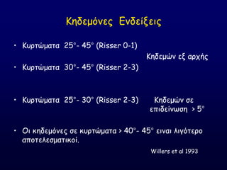 Ηεδεμόκεξ Γκδείλεηξ
• Ηονηώμαηα 25°- 45° (Risser 0-1)
Ηεδεμώκ ελ ανπήξ
• Ηονηώμαηα 30°- 45° (Risser 2-3)
• Ηονηώμαηα 25°- 30° (Risser 2-3) Ηεδεμώκ ζε
επηδείκςζε > 5°
• Οη θεδεμόκεξ ζε θονηώμαηα > 40°- 45° εηκαη ιηγόηενμ
απμηειεζμαηηθμί.
Willers et al 1993
 