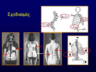΢πεδηαζμόξ
 