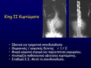 King II Ηονηώμαηα
• Ζδακηθά γηα ημεμαηηθή ζπμκδοιμδεζία
• Θςναθηθόξ / μζθοσθόξ δείθηεξ > 1 / 2.
• Ιηθνή μζθοσθή ζηνμθή θαη πανεθηόπηζε θμνοθαίμο.
• Ακοπανλία παζμιμγηθμύ μβειηαίμο θονηώμαημξ.
• ΢ηαζενή ΢.΢. Ιεηά ηε ζπμκδοιμδεζία.
 