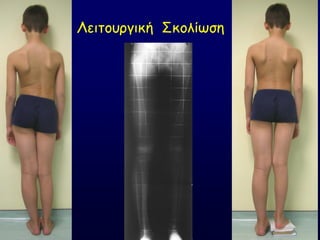 Θεηημονγηθή ΢θμιίςζε
 