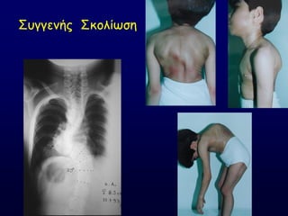 ΢ογγεκήξ ΢θμιίςζε
 