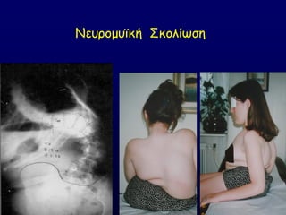 Κεονμμοσθή ΢θμιίςζε
 