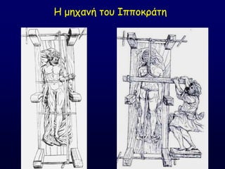 Ε μεπακή ημο Ζππμθνάηε
 