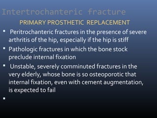 Intertrochanteric fracture
PRIMARY PROSTHETIC REPLACEMENT
 Peritrochanteric fractures in the presence of severe
arthritis of the hip, especially if the hip is stiff
 Pathologic fractures in which the bone stock
preclude internal fixation
 Unstable, severely comminuted fractures in the
very elderly, whose bone is so osteoporotic that
internal fixation, even with cement augmentation,
is expected to fail

 