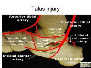Talus injury
 