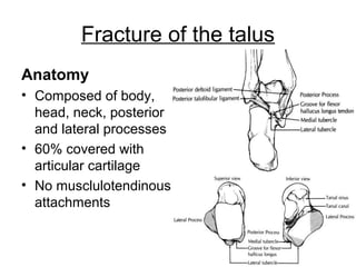 Fracture of the talus
Anatomy
• Composed of body,
head, neck, posterior
and lateral processes
• 60% covered with
articular cartilage
• No musclulotendinous
attachments
 