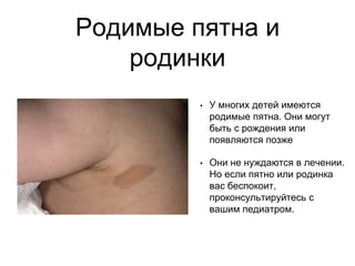 Родимые пятна и
родинки
• У многих детей имеются
родимые пятна. Они могут
быть с рождения или
появляются позже
• Они не нуждаются в лечении.
Но если пятно или родинка
вас беспокоит,
проконсультируйтесь с
вашим педиатром.
 