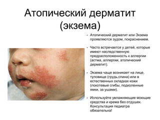 Атопический дерматит
(экзема)
• Атопический дерматит или Экзема
проявляются зудом, покраснением.
• Часто встречается у детей, которые
имеют наследственную
предрасположенность к аллергии
(астма, аллергии, атопический
дерматит).
• Экзема чаще возникает на лице,
туловище (грудь,спина) или в
естественных складках кожи
(локотевые сгибы, подколенные
ямки, за ушами).
• Используйте увлажняющие моющие
средства и крема без отдушек.
Консультация педиатра
обязательна!
 