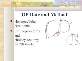 OP Date and Method
 Hepatocellular
carcinoma
 Left hepatectomy
and
cholecystectomy
on 2014-7-16
 