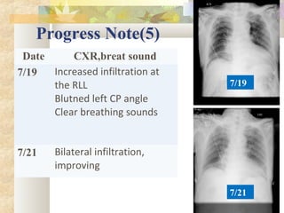 Progress Note(5)
Date CXR,breat sound
7/19 Increased infiltration at
the RLL
Blutned left CP angle
Clear breathing sounds
7/21 Bilateral infiltration,
improving
7/19
7/21
 