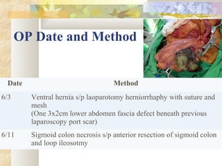 OP Date and Method
Date Method
6/3 Ventral hernia s/p laoparotomy herniorrhaphy with suture and
mesh
(One 3x2cm lower abdomen fascia defect beneath previous
laparoscopy port scar)
6/11 Sigmoid colon necrosis s/p anterior resection of sigmoid colon
and loop ileosotmy
 