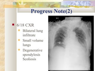 Progress Note(2)
 6/18 CXR
 Bilateral lung
infiltrate
 Small volume
lungs
 Degenerative
spondylosis
Scoliosis
 