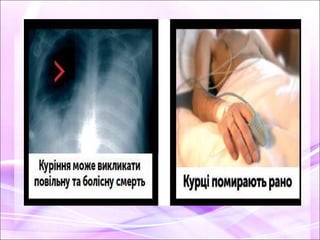 про шкідливість паління